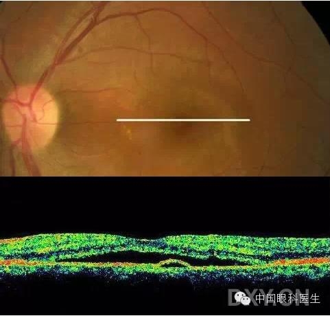 9��OCT��ͼ������ѧ��ɶϲ���������������ο���