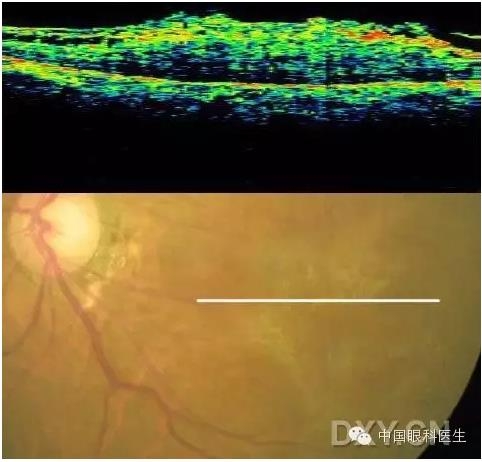 9��OCT��ͼ������ѧ��ɶϲ���������������ο���