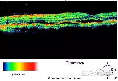 9��OCT��ͼ������ѧ��ɶϲ���������������ο���