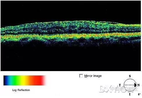 9��OCT��ͼ������ѧ��ɶϲ���������������ο���