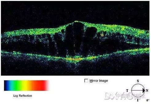 9��OCT��ͼ������ѧ��ɶϲ���������������ο���