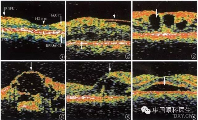 9��OCT��ͼ������ѧ��ɶϲ���������������ο���