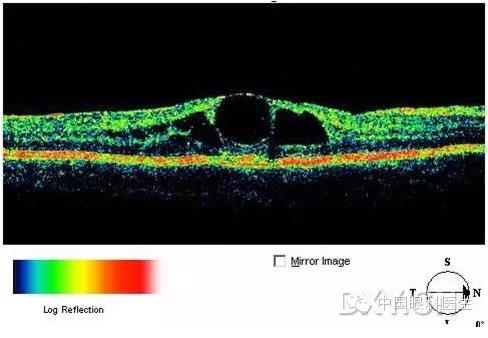 9��OCT��ͼ������ѧ��ɶϲ���������������ο���