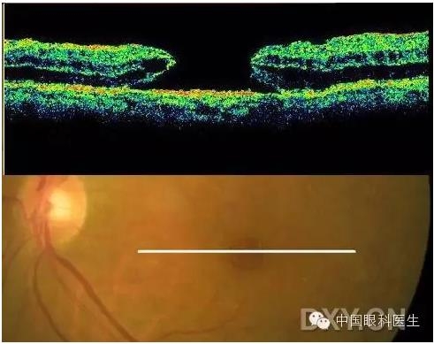 9��OCT��ͼ������ѧ��ɶϲ���������������ο���