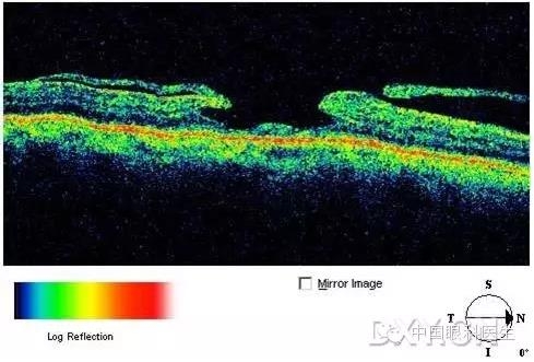 9��OCT��ͼ������ѧ��ɶϲ���������������ο���