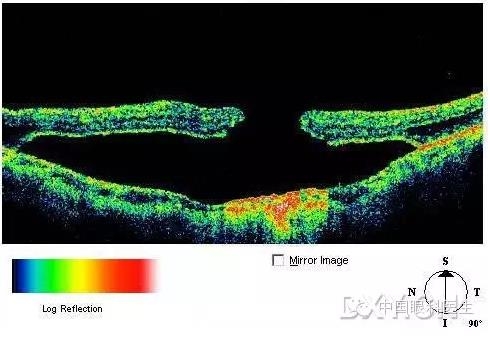 9��OCT��ͼ������ѧ��ɶϲ���������������ο���