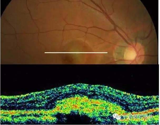 9��OCT��ͼ������ѧ��ɶϲ���������������ο���