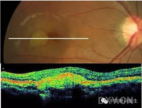 9��OCT��ͼ������ѧ��ɶϲ���������������ο���