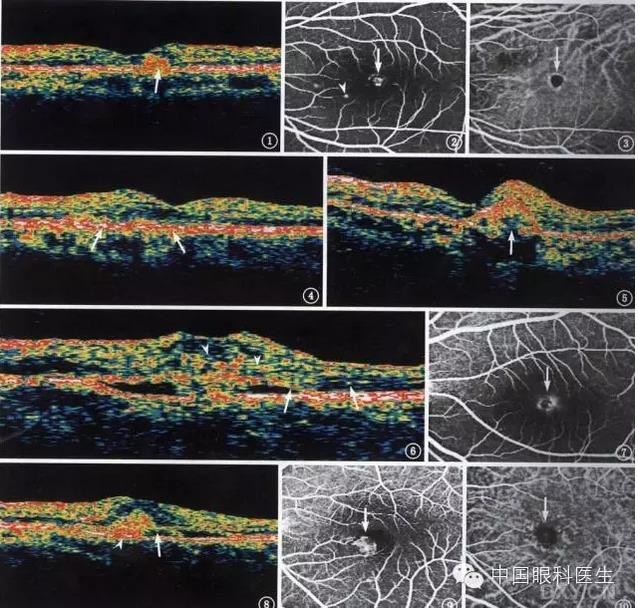 9��OCT��ͼ������ѧ��ɶϲ���������������ο���