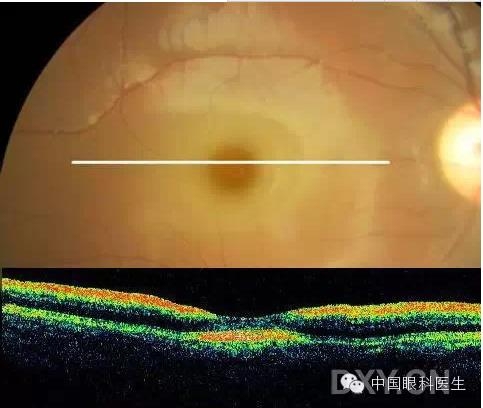 9��OCT��ͼ������ѧ��ɶϲ���������������ο���