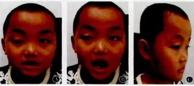 ����˫��ת����԰���� һ ˲Ŀ�ۺ���һ��