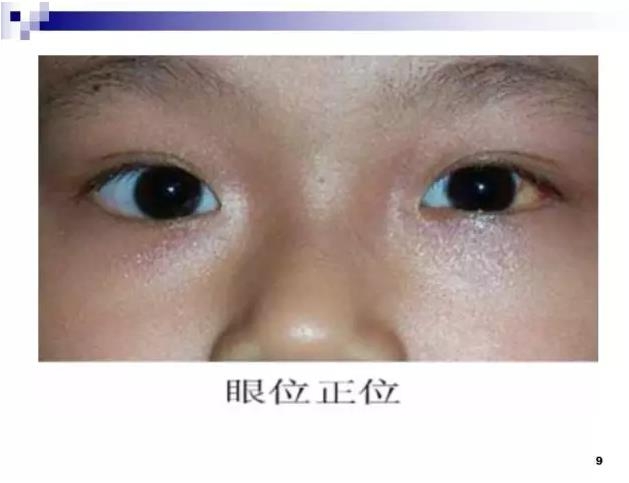 б�������ӵĻ���֪ʶ