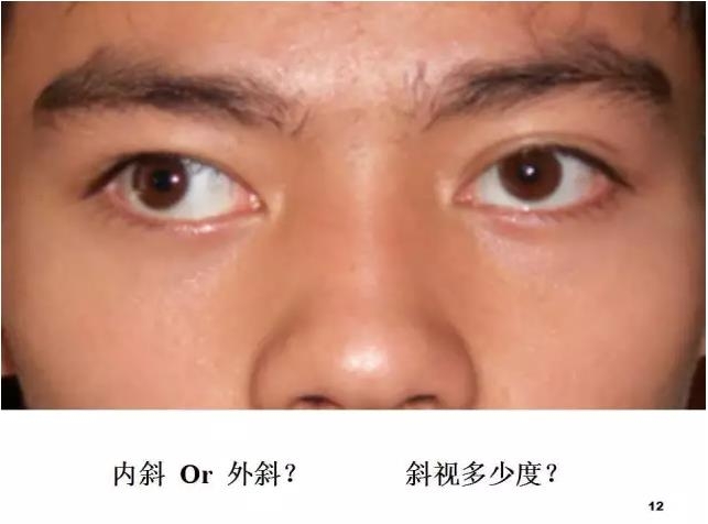 б�������ӵĻ���֪ʶ