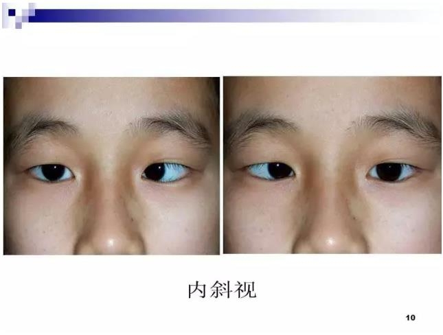 б�������ӵĻ���֪ʶ