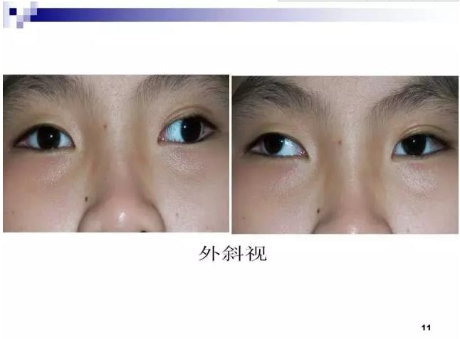 б�������ӵĻ���֪ʶ