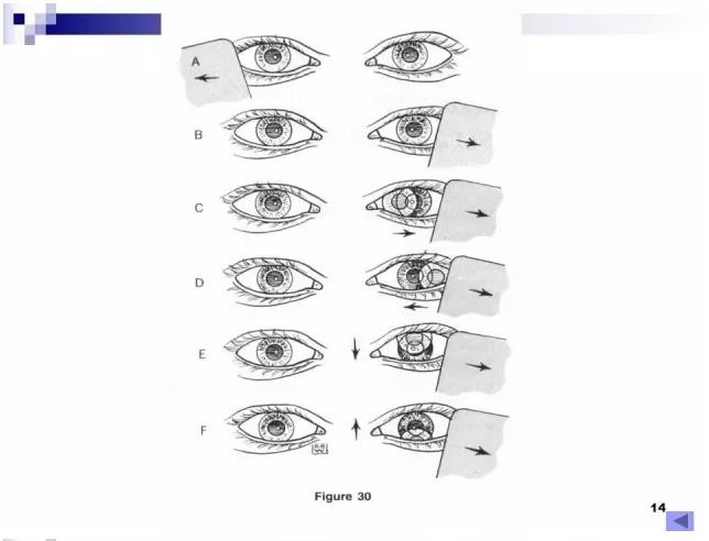 б�������ӵĻ���֪ʶ