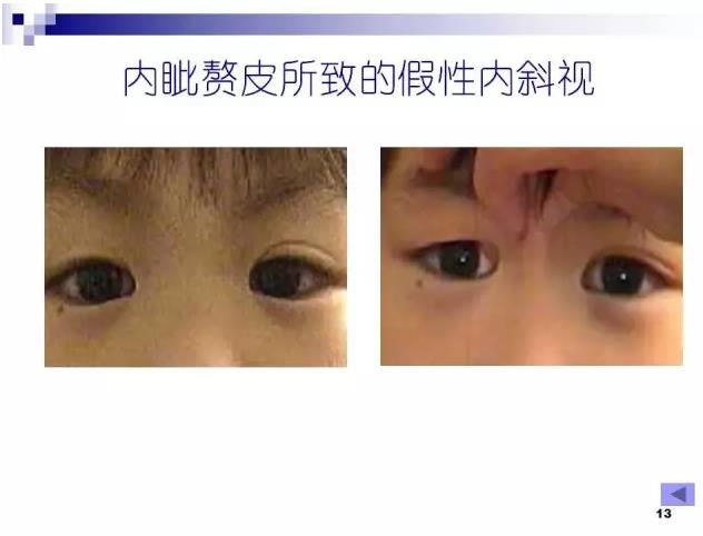 б�������ӵĻ���֪ʶ