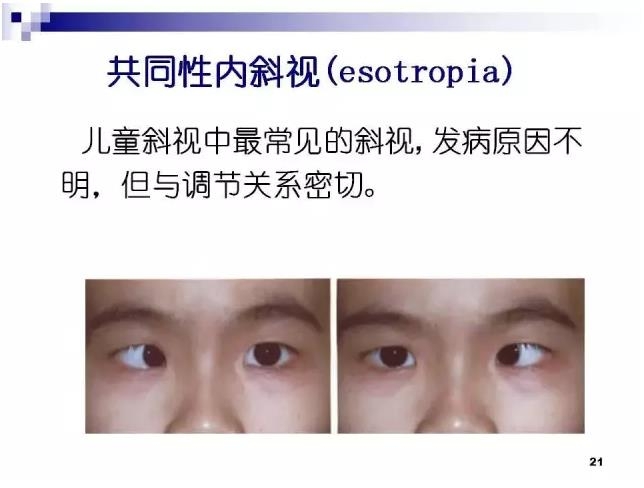 б�������ӵĻ���֪ʶ