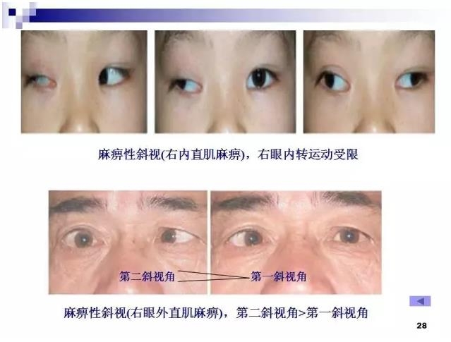 б�������ӵĻ���֪ʶ