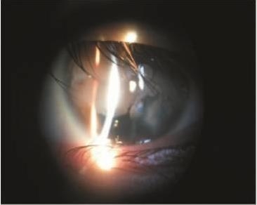 ������������Ĥ��Ƥ׼���Ӽ��������Խ�Ĥ���������ƶ�ͯ��Ĥ��״����һ��