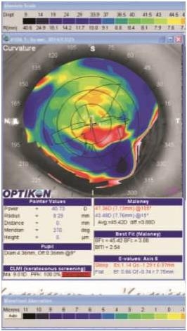 ������������Ĥ��Ƥ׼���Ӽ��������Խ�Ĥ���������ƶ�ͯ��Ĥ��״����һ��