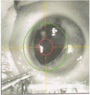 ������������Ĥ��Ƥ׼���Ӽ��������Խ�Ĥ���������ƶ�ͯ��Ĥ��״����һ��