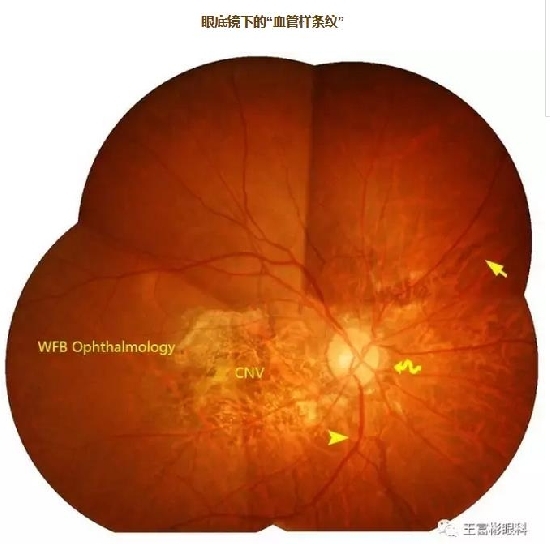 �۵ס�Ѫ�������ơ���Ӱ��ѧ�ص������