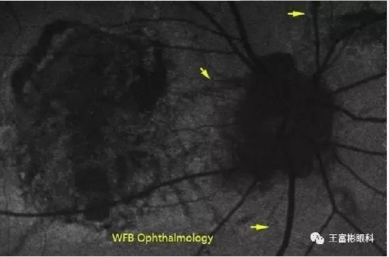 �۵ס�Ѫ�������ơ���Ӱ��ѧ�ص������