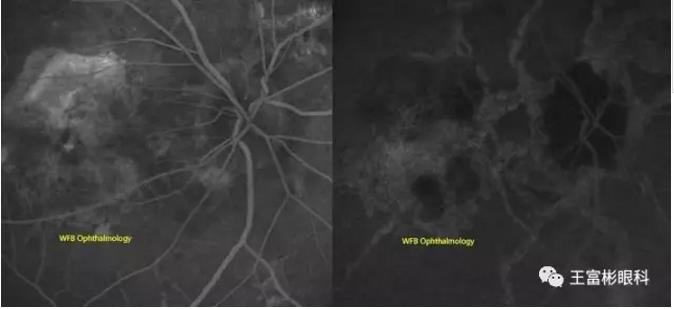 �۵ס�Ѫ�������ơ���Ӱ��ѧ�ص������