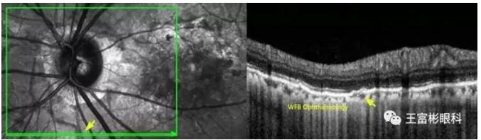 �۵ס�Ѫ�������ơ���Ӱ��ѧ�ص������