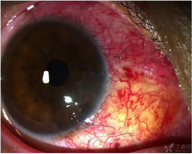 ��ô������״��������������5000������ҽ���ĵ÷�����