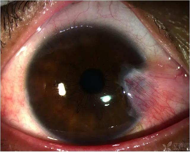 ��ô������״��������������5000������ҽ���ĵ÷�����