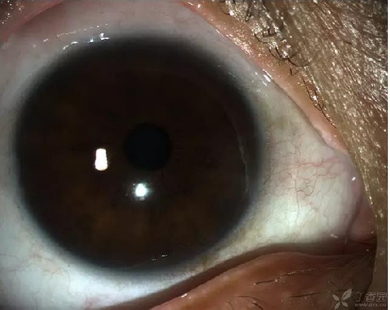 ��ô������״��������������5000������ҽ���ĵ÷�����