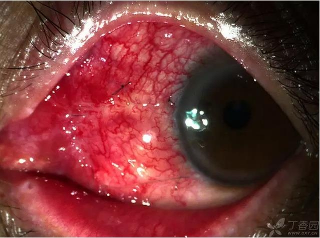 ��ô������״��������������5000������ҽ���ĵ÷�����