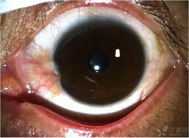 ��ô������״��������������5000������ҽ���ĵ÷�����