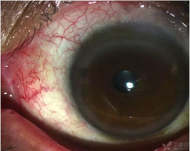 ��ô������״��������������5000������ҽ���ĵ÷�����