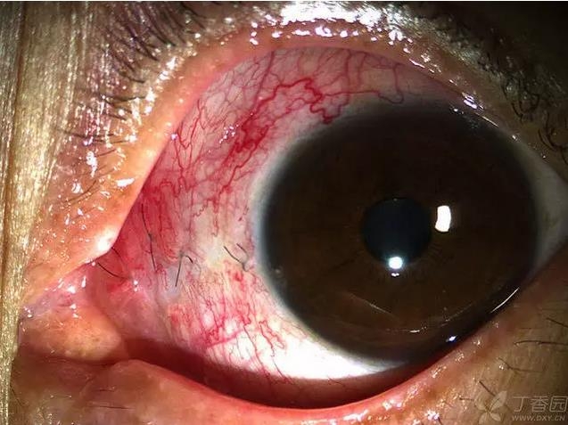 ��ô������״��������������5000������ҽ���ĵ÷�����