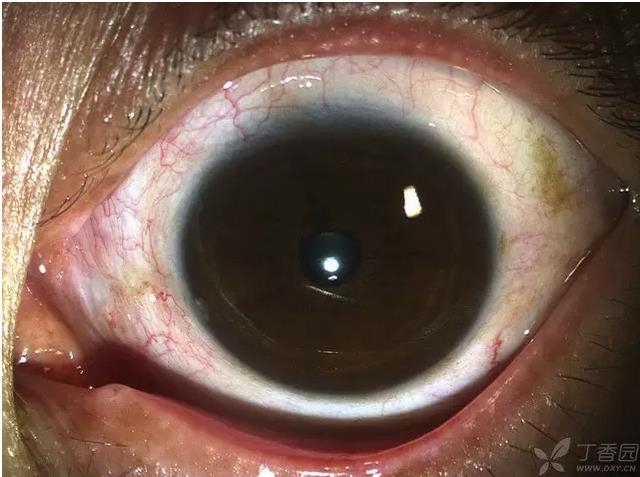 ��ô������״��������������5000������ҽ���ĵ÷�����