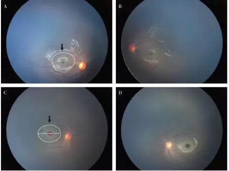 ������������-ƥ�˲��ϲ�˫���۵׻ư��쳣����