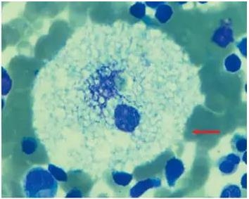 ������������-ƥ�˲��ϲ�˫���۵׻ư��쳣����