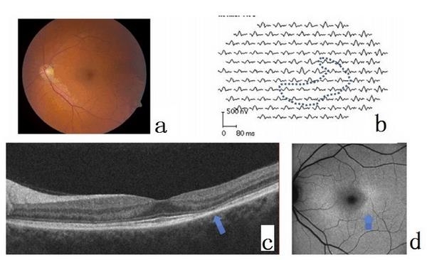 �����ۿ�Э��ָ�ϣ���୼��ǻ��������Ĥ����ɸ��