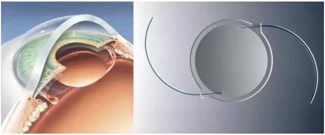 ȫ�����������������Ĥʵ�ֹ���������ڣ���ȫģ���������۾�ͫ��