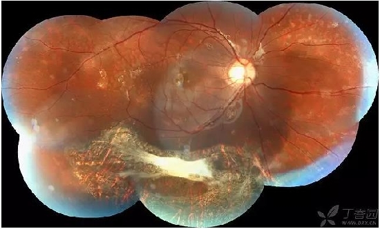 �����������۵ײ���ͼƬ