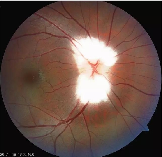 �����������۵ײ���ͼƬ