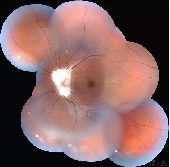 �����������۵ײ���ͼƬ