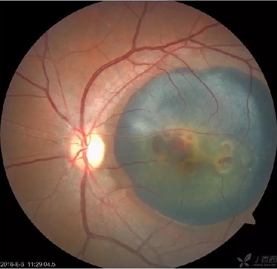 �����������۵ײ���ͼƬ