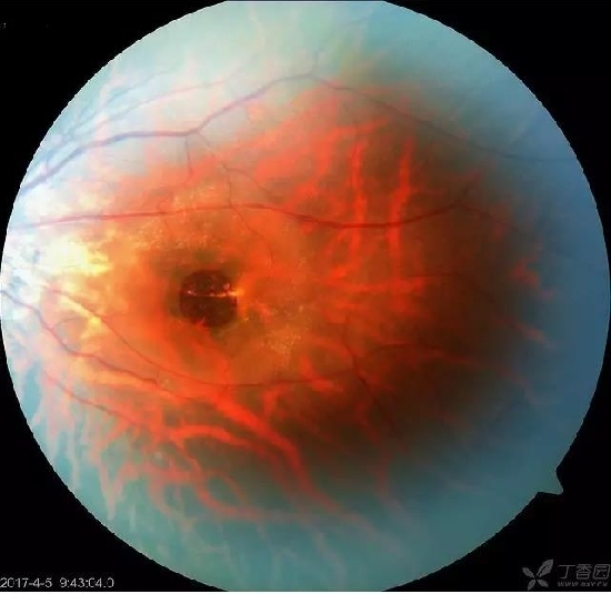 �����������۵ײ���ͼƬ