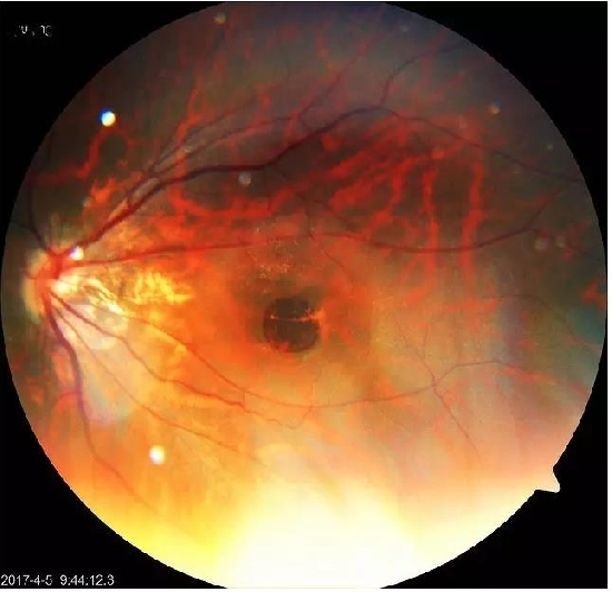 �����������۵ײ���ͼƬ