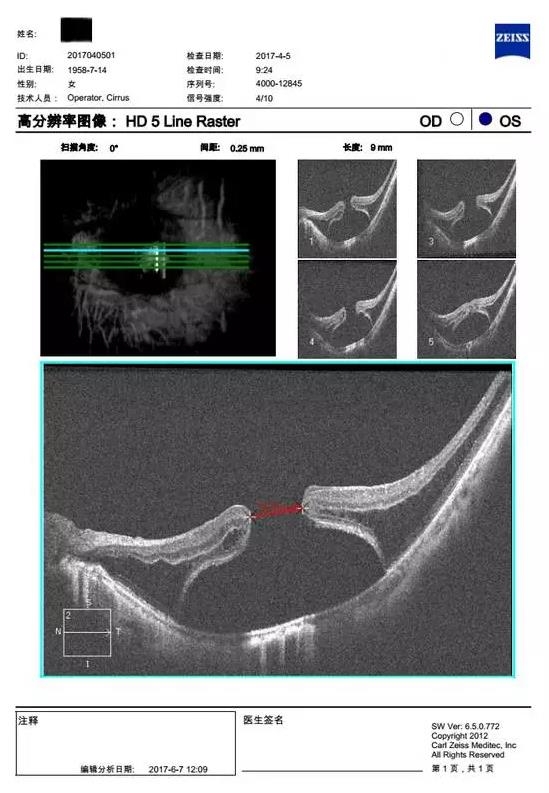 �����������۵ײ���ͼƬ