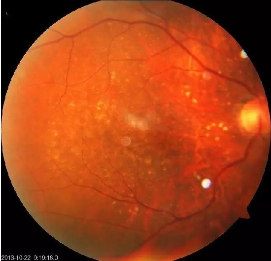 �����������۵ײ���ͼƬ